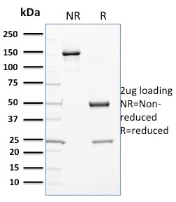 Cytochrome P450 3A1 / CYP3A1 Monoclonal Mouse Antibody (P6)