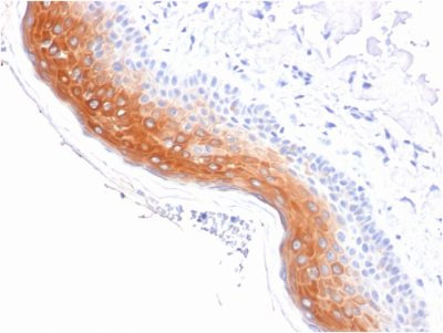 Cytokeratin 1 Monoclonal Mouse Antibody (KRT1/1840)