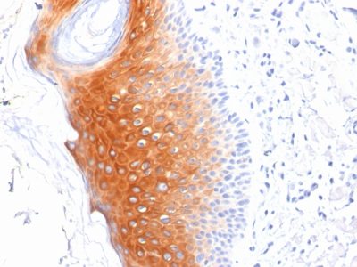 Cytokeratin 1 Monoclonal Mouse Antibody (LHK1)