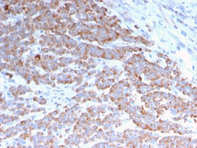 Cytokeratin 18 Recombinant Monoclonal Mouse Antibody (rKRT18/1190)