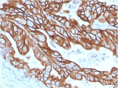 Cytokeratin 18 Recombinant Monoclonal Rabbit Antibody (KRT18/2808R)