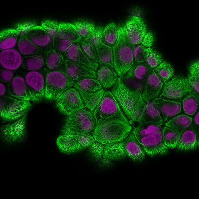Cytokeratin 18 Recombinant Monoclonal Rabbit Antibody (KRT18/2808R)