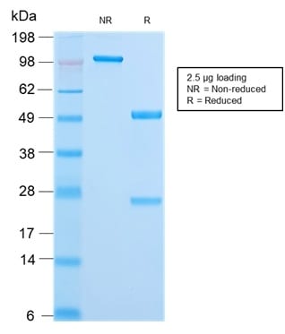 Cytokeratin 18 Recombinant Monoclonal Rabbit Antibody (KRT18/2808R)