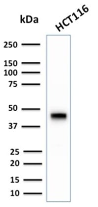Cytokeratin 18 Recombinant Monoclonal Rabbit Antibody (KRT18/2808R)