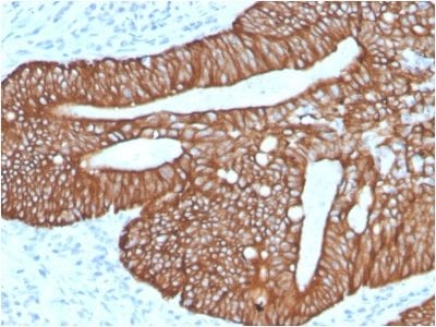 Cytokeratin 18 Recombinant Monoclonal Rabbit Antibody (KRT18/2819R)