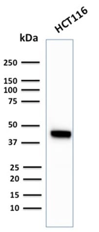 Cytokeratin 18 Recombinant Monoclonal Rabbit Antibody (KRT18/2819R)