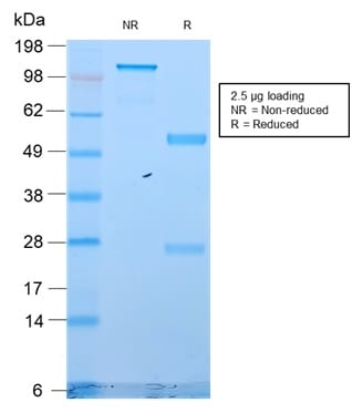 Cytokeratin 18 Recombinant Monoclonal Rabbit Antibody (KRT18/2819R)