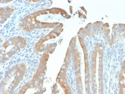 Cytokeratin 19 Recombinant Monoclonal Mouse Antibody (rKRT19/799)