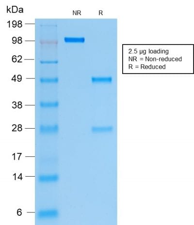 Cytokeratin 19 Recombinant Monoclonal Mouse Antibody (rKRT19/799)