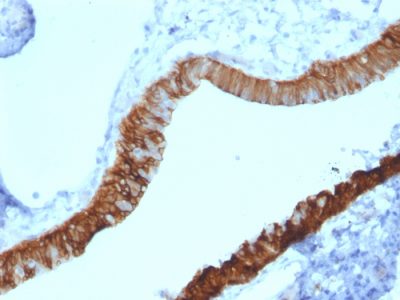 Cytokeratin 3 Monoclonal Mouse Antibody (KRT3/2130)