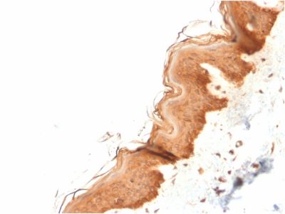 Cytokeratin 4 Monoclonal Mouse Antibody (KRT4/2804)