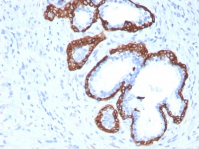 Cytokeratin 5 Monoclonal Mouse Antibody (KRT5/3594)