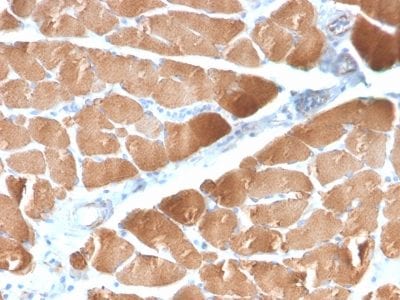 Desmin Recombinant Monoclonal Rabbit Antibody (DES/2960R)