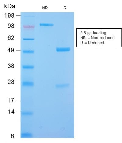 Desmin Recombinant Monoclonal Rabbit Antibody (DES/2960R)