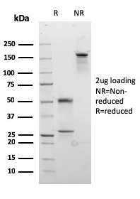 Desmocollin-2/3 Recombinant Monoclonal Mouse Antibody (rDSC2/3437)