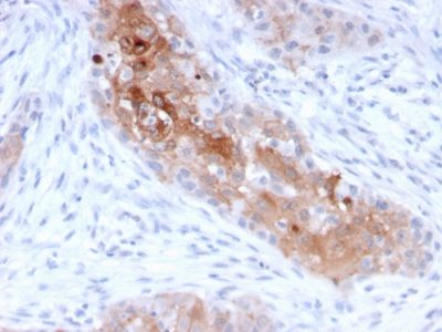 Desmoglein-1 Monoclonal Mouse Antibody (32-2B)