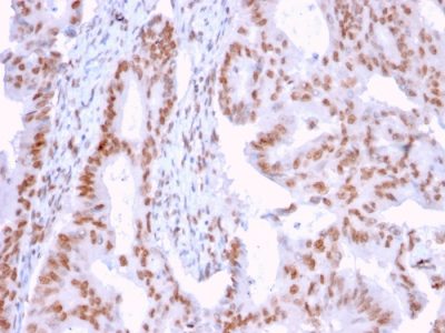 DMC1 Monoclonal Mouse Antibody (2H12/4)