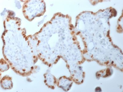 DNMT1 / DNA Methyltransferase 1 Monoclonal Mouse Antibody (DNMT1/2061)