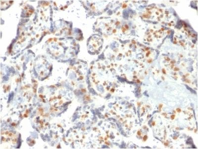 DNMT3A / DNA Methyltransferase 3 Alpha Monoclonal Mouse Antibody (PCRP-DNMT3A-1E2)
