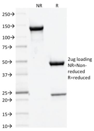 DNMT3A / DNA Methyltransferase 3 Alpha Monoclonal Mouse Antibody (PCRP-DNMT3A-1E2)