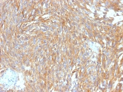 DOG-1 / TMEM16A Recombinant Monoclonal Rabbit Antibody (DG1/2564R)