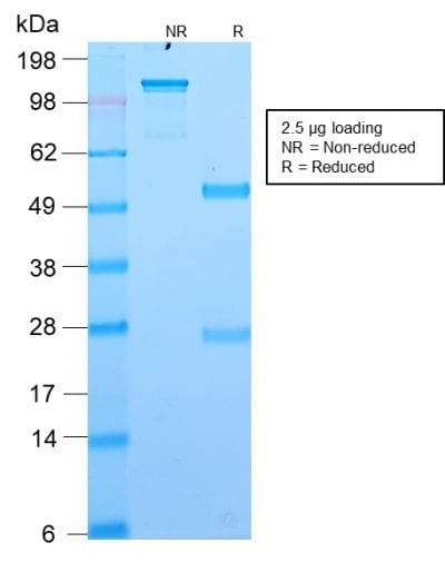 DOG-1 / TMEM16A Recombinant Monoclonal Rabbit Antibody (DG1/2564R)
