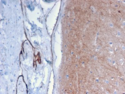 Drebrin 1 Monoclonal Mouse Antibody (DBN1/2879)