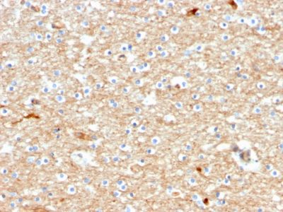 Drebrin 1 Monoclonal Mouse Antibody (DBN1/2880)
