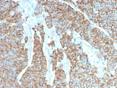 Drebrin 1 Monoclonal Mouse Antibody (DBN1/3393)