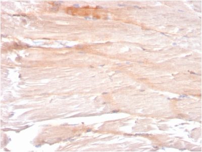Dystrophin Monoclonal Mouse Antibody (DMD/3241)