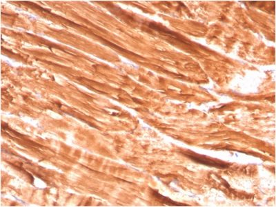 Dystrophin Monoclonal Mouse Antibody (DMD/3242)