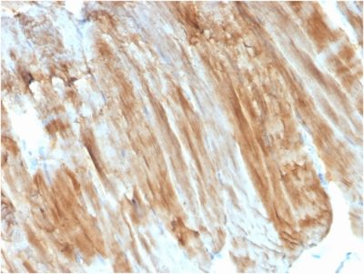Dystrophin Monoclonal Mouse Antibody (DMD/3243)