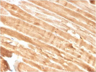 Dystrophin Monoclonal Mouse Antibody (DMD/3244)