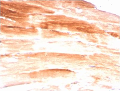 Dystrophin Monoclonal Mouse Antibody (DMD/3245)