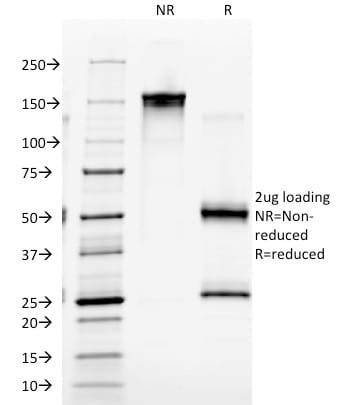 EGFR Monoclonal Mouse Antibody (GFR/2341)