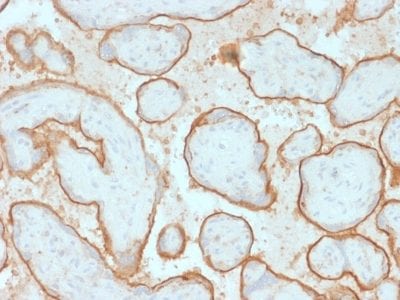 EGFR Monoclonal Mouse Antibody (GFR/2341)