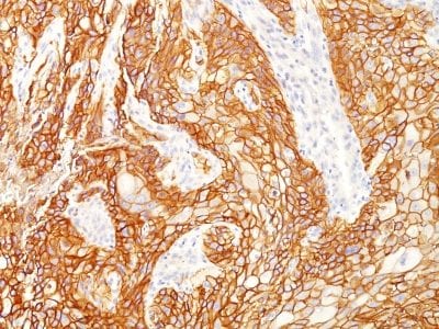 EGFR Monoclonal Mouse Antibody (GFR/2341)