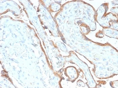 EGFR Recombinant Monoclonal Rabbit Antibody (GFR/2968R)