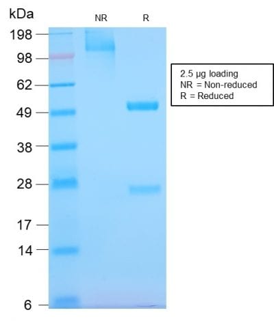 EGFR Recombinant Monoclonal Rabbit Antibody (GFR/2968R)