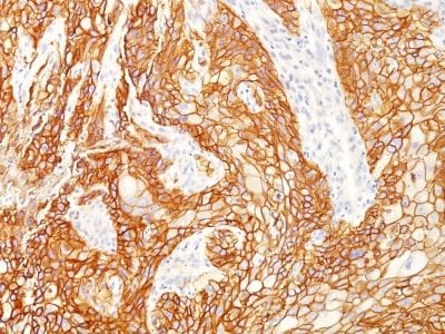 EGFRvIII Recombinant Monoclonal Rabbit Antibody (GFR/2600R)