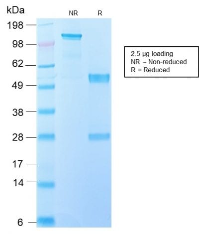 EGFRvIII Recombinant Monoclonal Rabbit Antibody (GFR/2600R)