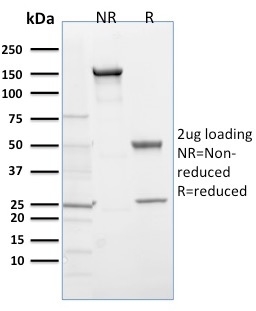 EGLN1 / PHD2 Monoclonal Mouse Antibody (366G/76/3)