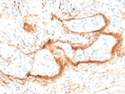 Elastin Monoclonal Mouse Antibody (ELN/1981)