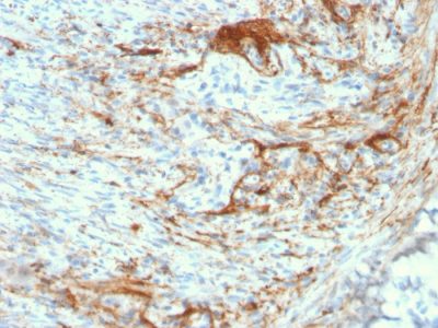 Elastin Recombinant Monoclonal Rabbit Antibody (ELN/3131R)
