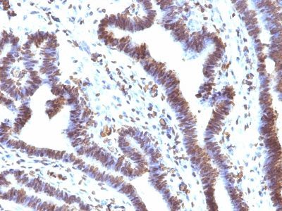 EMI1 Monoclonal Mouse Antibody (EMI1/1176)