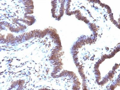EMI1 Monoclonal Mouse Antibody (EMI1/1176)