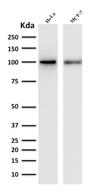 ENAH / MENA Monoclonal Mouse Antibody (ENAH/1988)