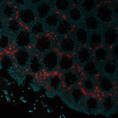 Eosinophil Peroxidase Monoclonal Mouse Antibody (AHE-1)