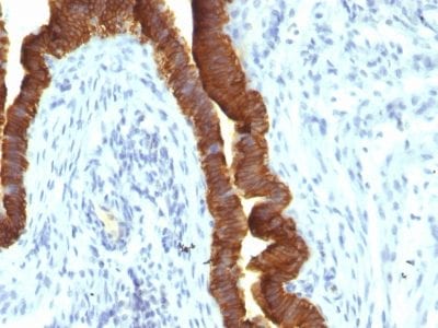 Ep-CAM / CD326 Recombinant Monoclonal Mouse Antibody (rEGP40/1110)