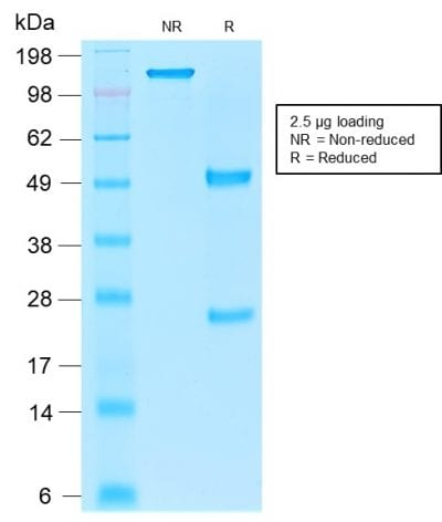 Ep-CAM / CD326 Recombinant Monoclonal Mouse Antibody (rEGP40/1110)